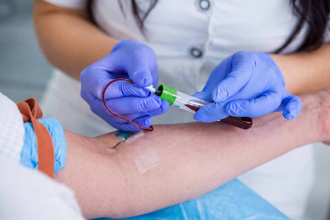 Bilan sanguin et hypotension