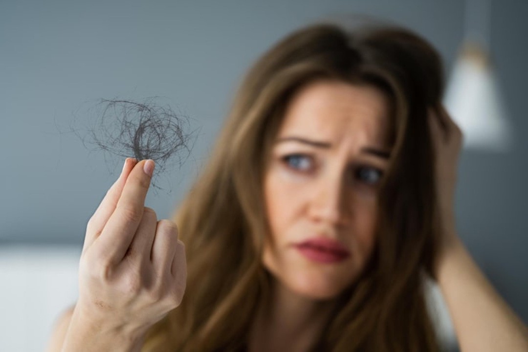 chute de cheveux tcmh