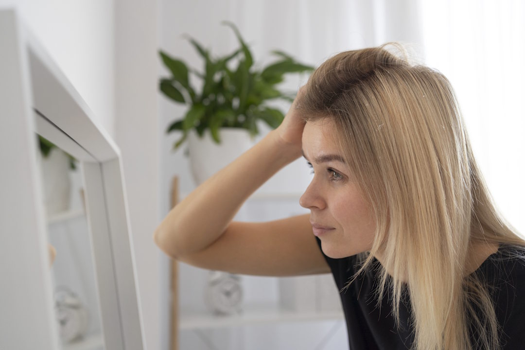 Une femme qui perd ses cheveux, symptômes d'un dérèglement hormonal un 