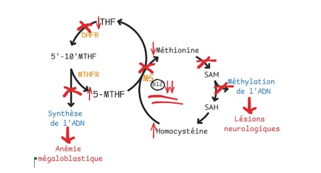 Carence en vitamine B12