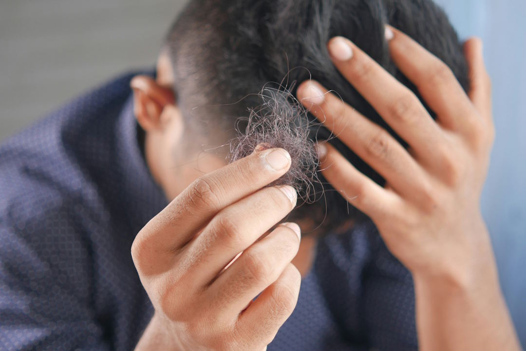 Perte de cheveux et zinc
