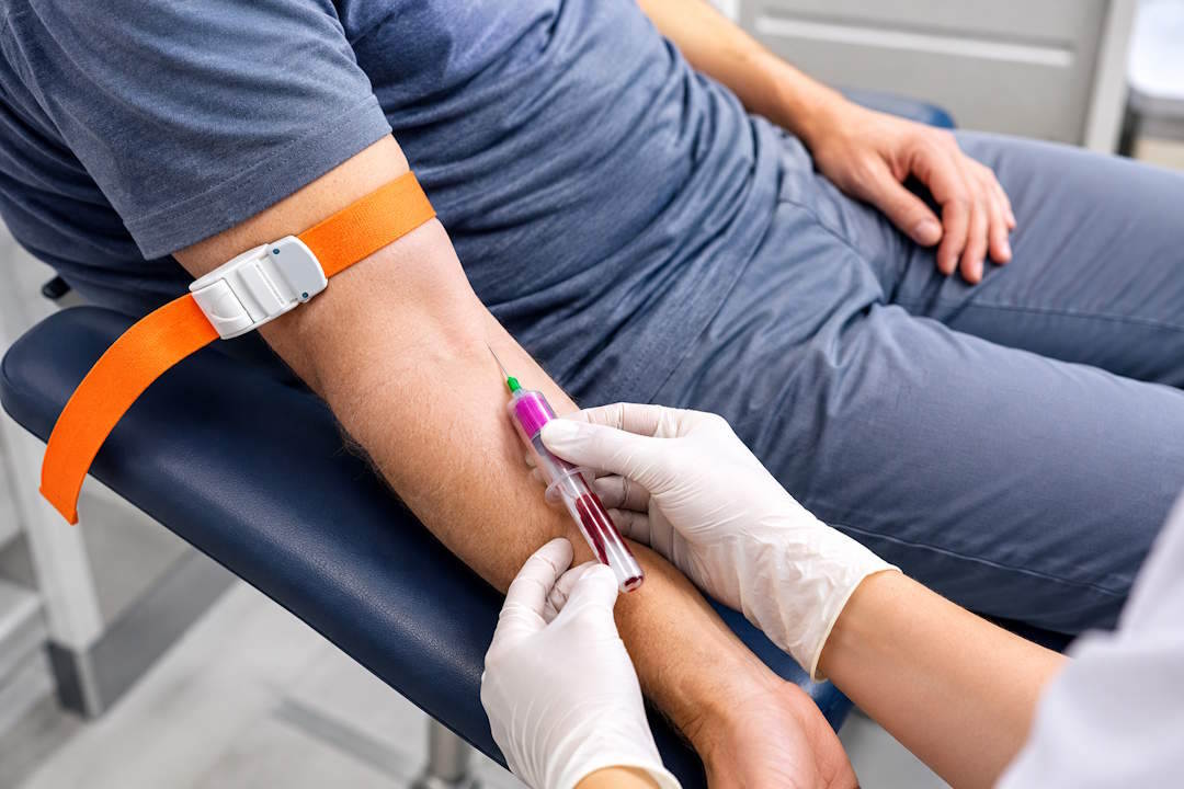 Diagnostic de carence en vitamine D