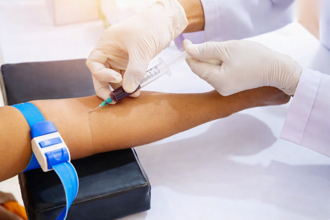 Diagnostique d'une phlébite 