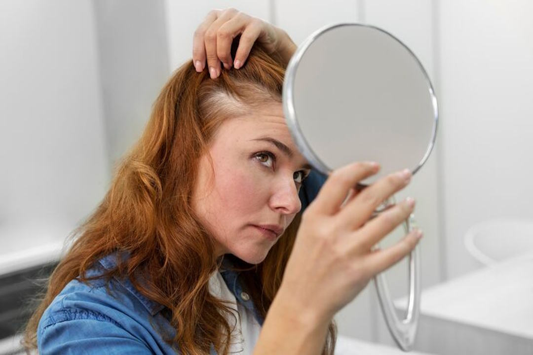 Une femme qui regarde son cuir chevelu douloureux 