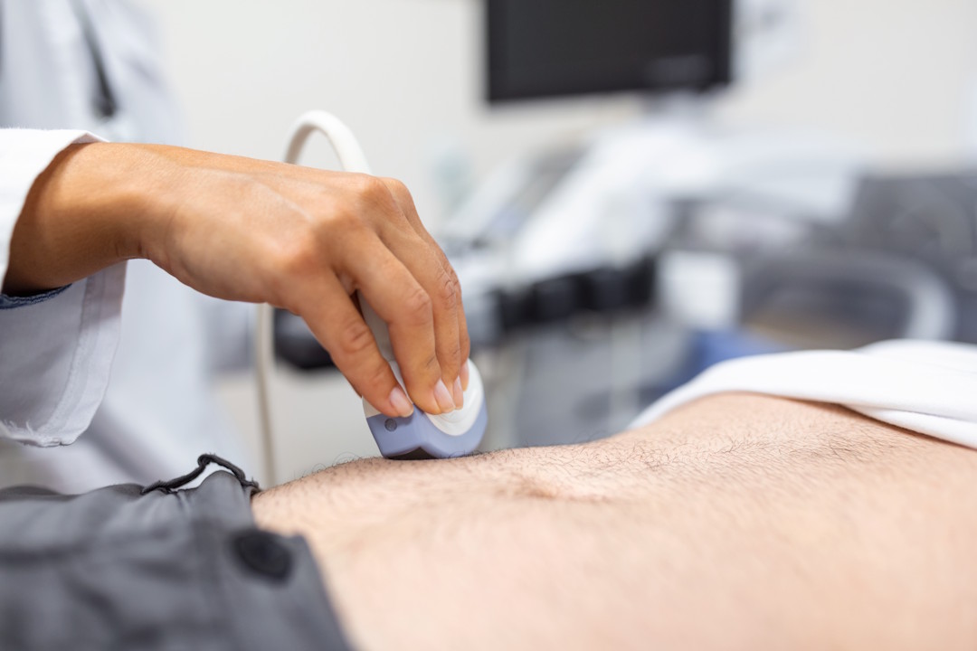 Le scanner abdomino-pelvien, douleur au rein