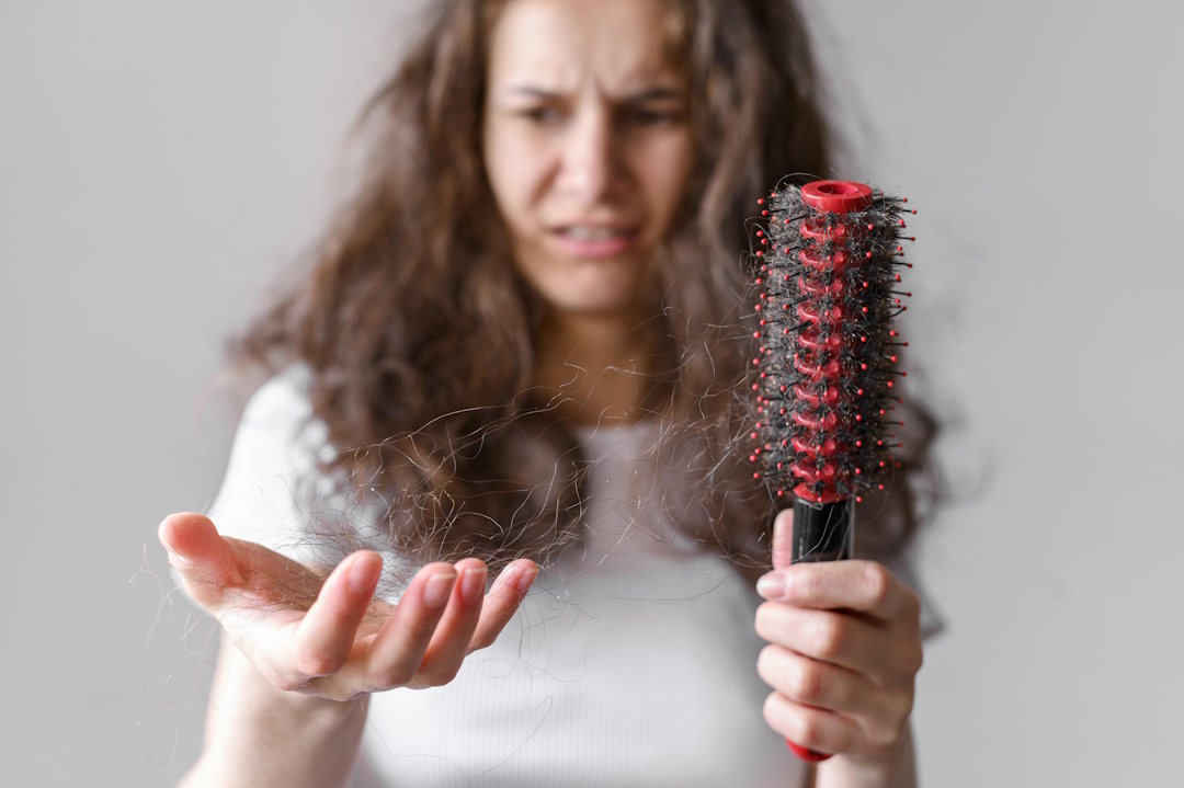 Chute de cheveux et manque de fer