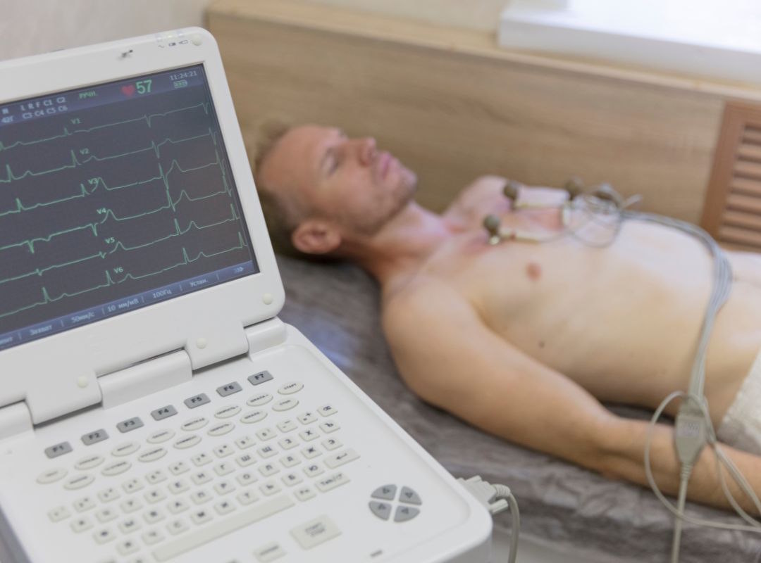 Crise cardiaque et ECG