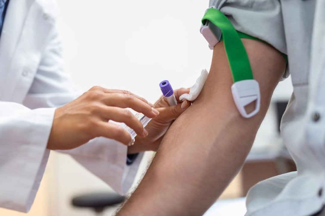 prise de sang pour doser les phosphatases alcalines 