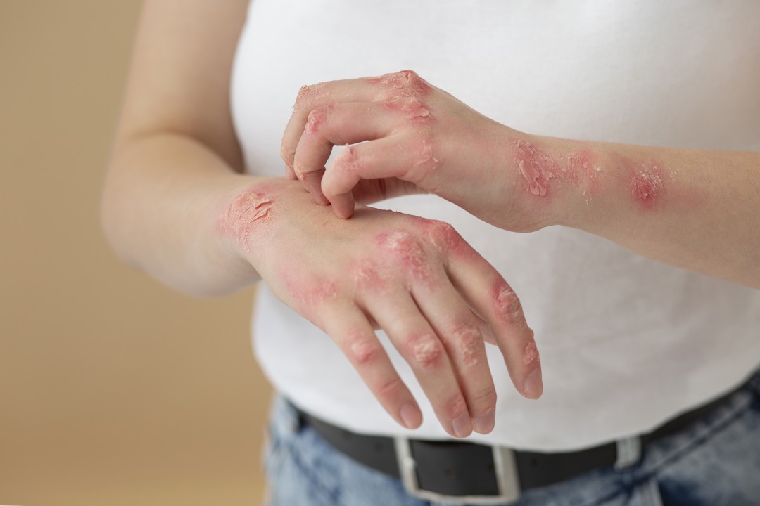 Infections que le système immunitaire lutte