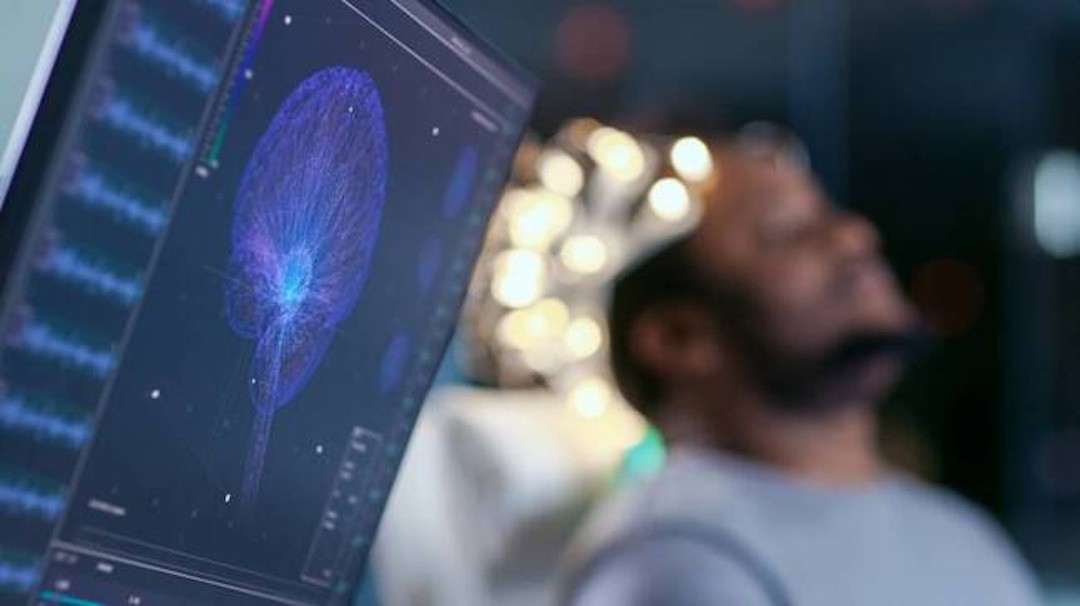 Les bienfaits de l'ashwagandha pour le cerveau
