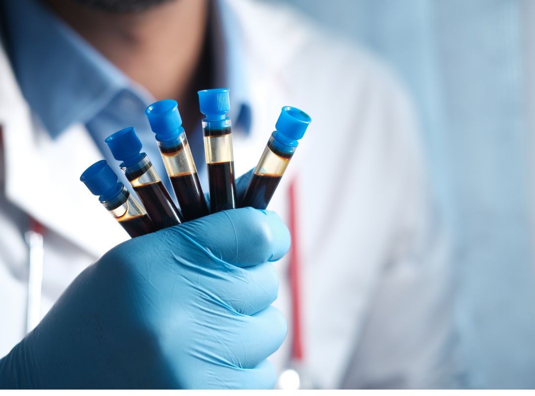 Test sérologique mononucléose