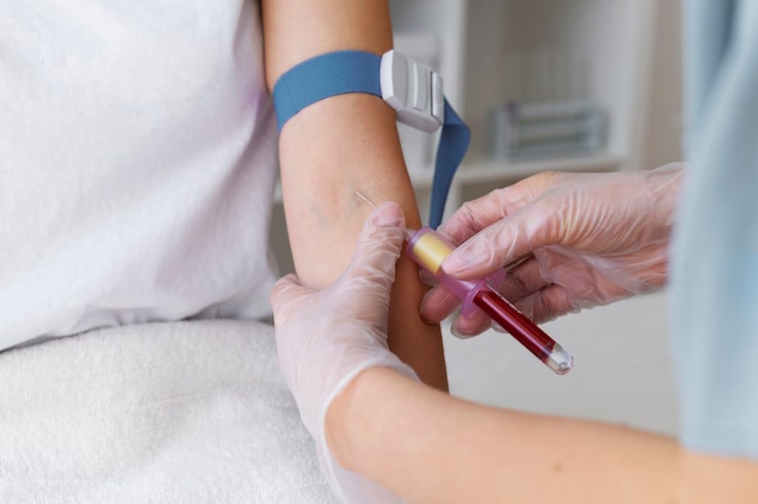 Prise de sang et triglycerides