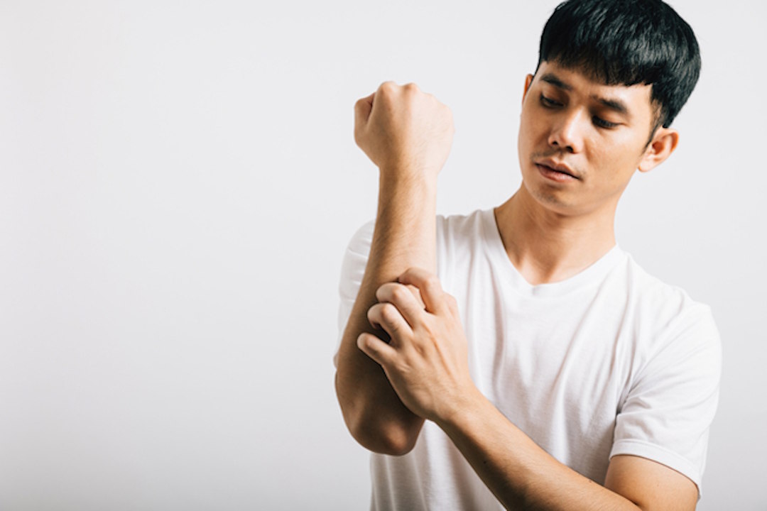 Vitamine D et psoriasis