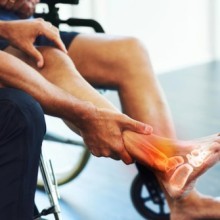 Arthrose cheville : symptômes, causes et solutions pour soulager la douleur