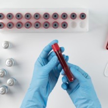 Phosphatases alcalines : comprendre votre taux et votre santé métabolique