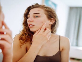 Champignons, mycoses sur la peau et stress : quel est le lien et comment agir ?