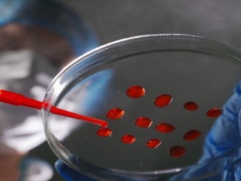 Neutrophiles haut ou bas : comprendre le rempart de votre immunité