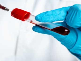 Hémoglobine basse ou élevée : comprendre votre taux