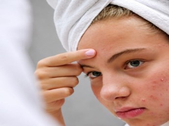 Acné sévère : causes et traitements médicaux