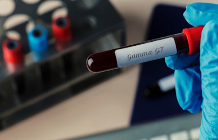 Gamma GT élevés et fatigue : causes possibles et solutions
