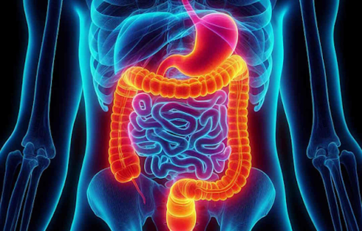 Intestin poreux : 4 solutions pour réparer votre barrière intestinale