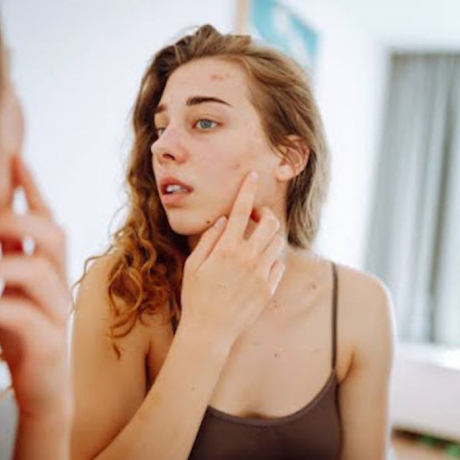 Champignons, mycoses sur la peau et stress : quel est le lien et comment agir ?