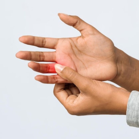 Douleur à l’articulation d’un doigt : causes, symptômes et solutions efficaces