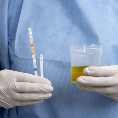 Urine mousseuse : quelles sont les causes et quand faut-il s'inquiéter ?