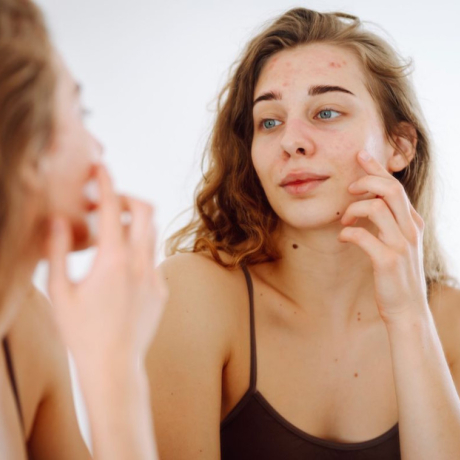 Peau sèche : causes, symptômes et solutions