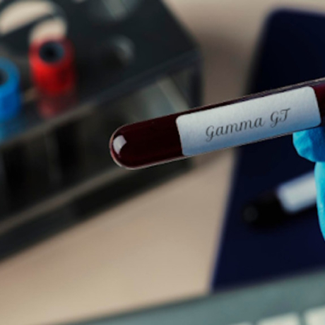 Gamma GT élevés et fatigue : causes possibles et solutions