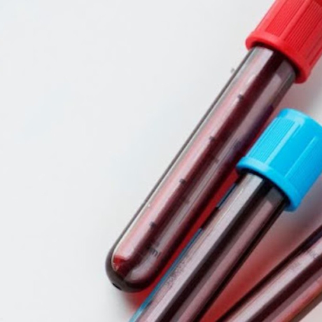 VGM élevé et fatigue : focus sur vos globules rouges