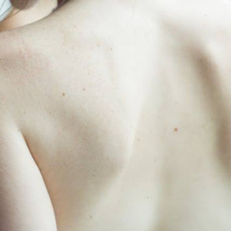Arthrose inter-apophysaire : symptômes, causes et solutions naturelles