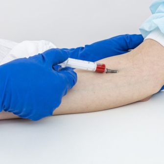 Transaminases : comprendre vos taux ASAT et ALAT pour votre foie
