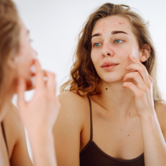 Peau sèche : causes, symptômes et solutions
