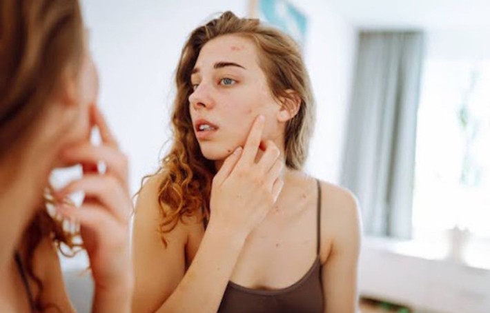 Champignons, mycoses sur la peau et stress : quel est le lien et comment agir ?