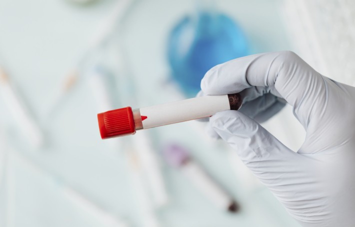 CCMH : comprendre votre taux et la qualité de vos globules rouges