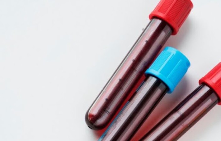 VGM élevé et fatigue : focus sur vos globules rouges