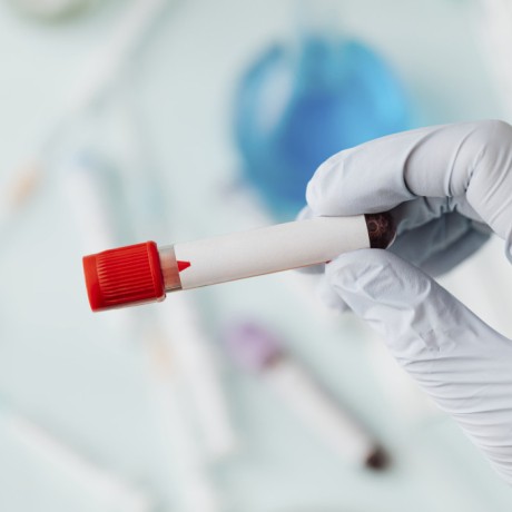 CCMH : comprendre votre taux et la qualité de vos globules rouges