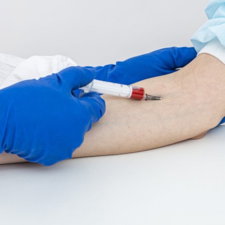 Transaminases : comprendre vos taux ASAT et ALAT pour votre foie