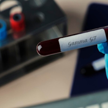 Gamma GT élevés et fatigue : causes possibles et solutions